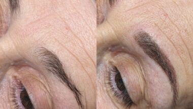 The procedure you see in the image is called permanent makeup. The left picture shows a person's eyebrows before the procedure. The eyebrows are thin and sparse. The right picture shows a person's eyebrows after the procedure. The eyebrows have become thicker and more expressive, which gives the face beauty and confidence.